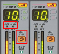 導子脱落検出機能・最大出力抑制機能